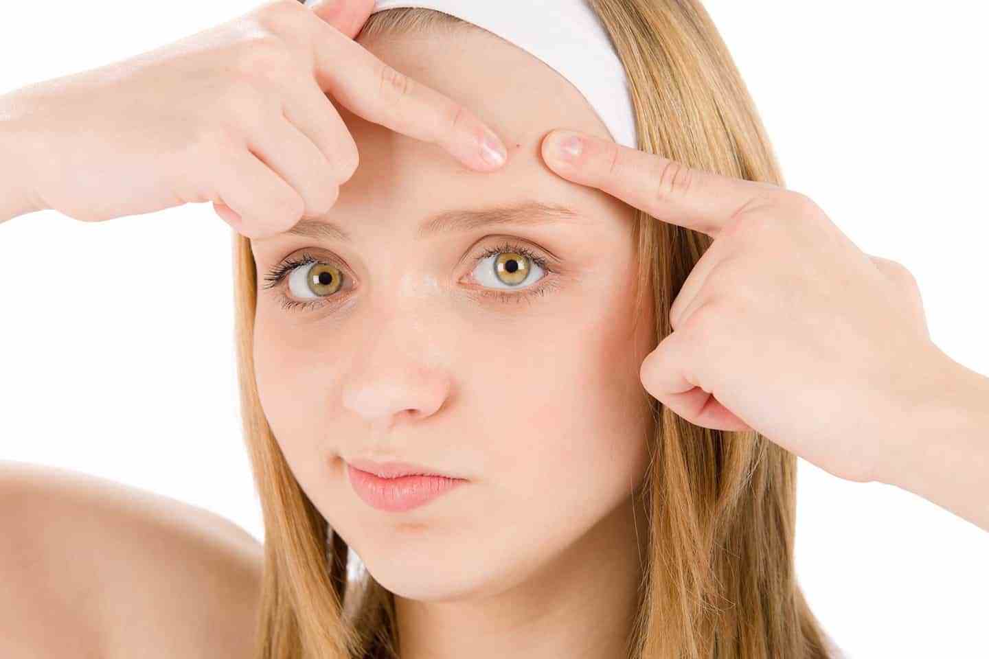 Como Usar Mel E Canela Para Tratar A Acne: Isso Realmente Funciona?