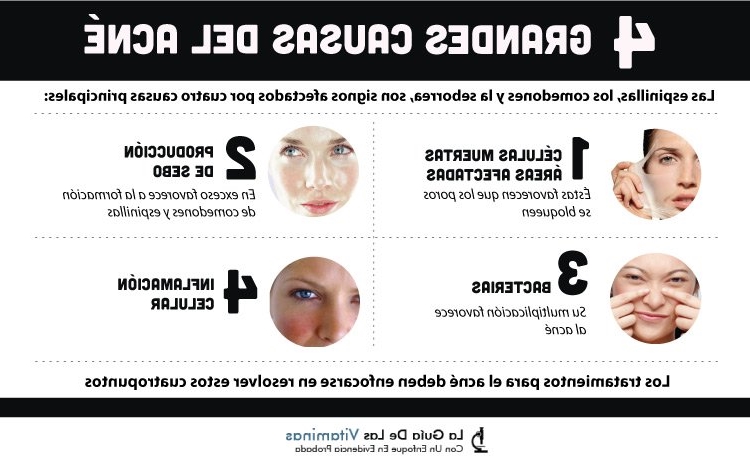 tratamientos-para-el-acne_144
