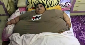operar-obesidade-mulher-mais-velha-do-mundo-5