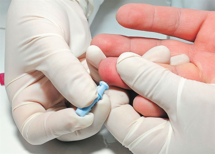 teste-rapido-para-tuberculose-do-hiv-2